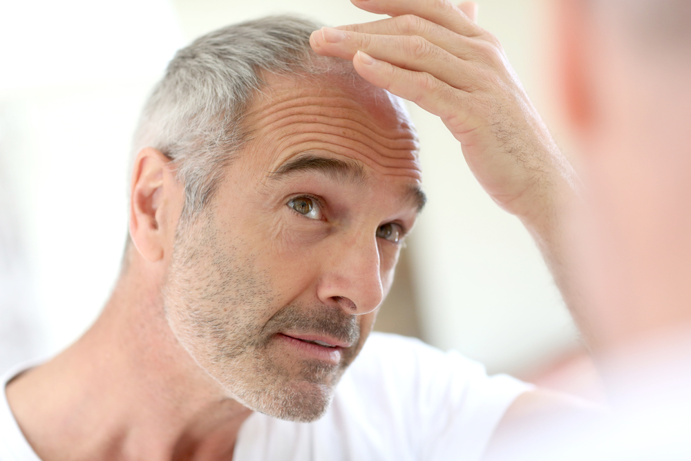 Coupe de cheveux, calvitie quelle solution pour la dissimuler